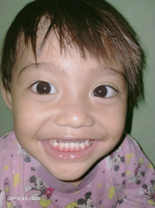 Matanya bergerak saat menatap lama