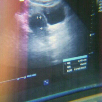 hamil anak pertama :*