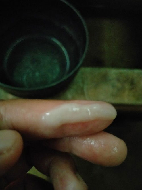 มูกหรือตกขาว