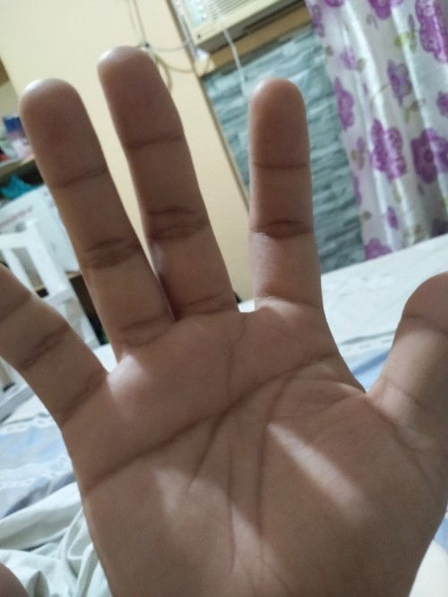 pamamaga 38weeks and 3 days pregnancy