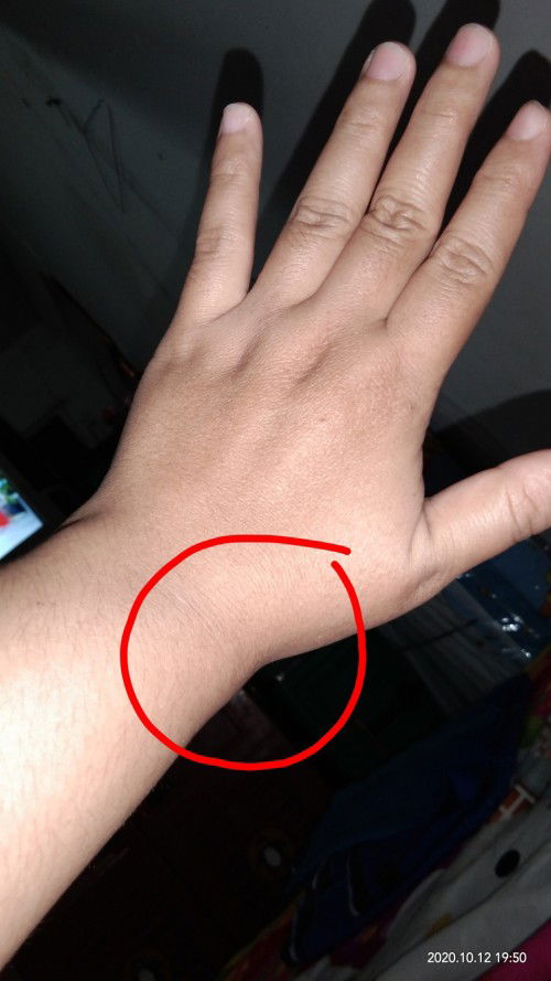 Nyeri pergelangan tangan