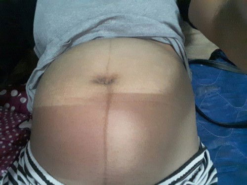 ท้องได้27w2Dแต่เจอคนชอบทักว่าท้องเล็ก