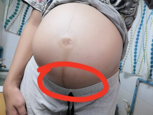 ปวดหน่วงๆตรงนี้ปกติมั้ยค่ะ