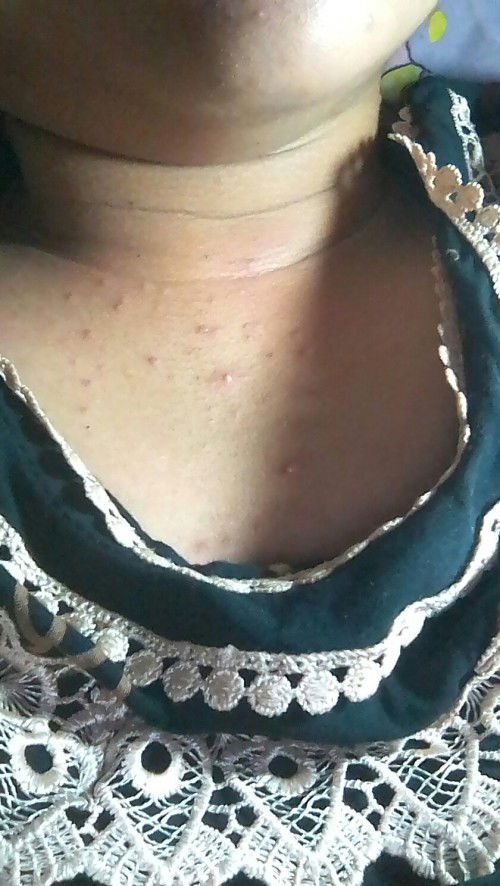 Diusia kandungan 32w 2d