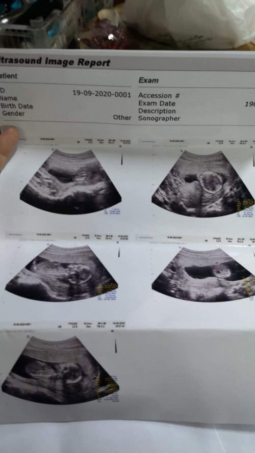 15w. 💕💕💕💕

ณ.ตอนนี้18w. แล้วจ้า