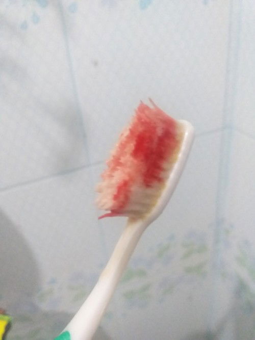 แปรงฟันแล้วเลือดออก