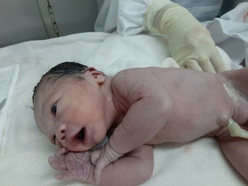 MY INDUCE LABOR STORY @ 41 WEEKS

Caelan Miguel
EDD: Sep 26, 2020
Date of birth: Oct 3, 2020
via NVD