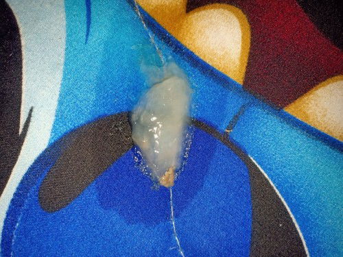 มูกแบบนี้คือสัญญาณใกล้คลอดไหมค่ะ