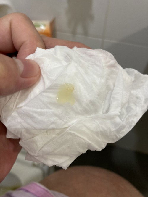 Ito na b ang mucus plug???