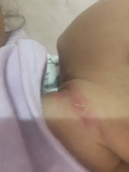 ลุกเราเป้นอะไรหรอค่ะขอคำตอบหน่อยค่ะ