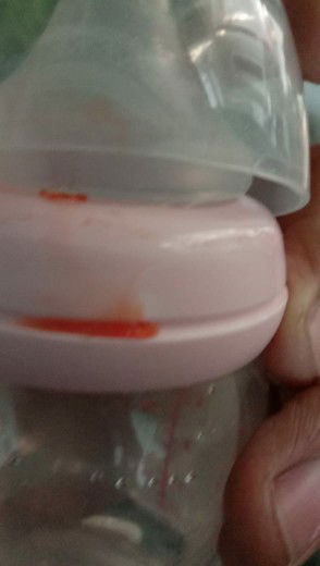 Gusi berdarah bayi 9 bulan