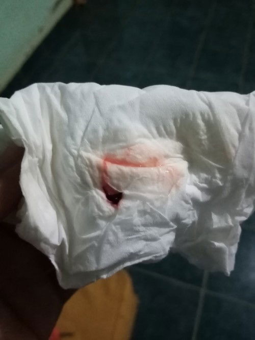 20ตุลาคม​ กำหนดคลอด