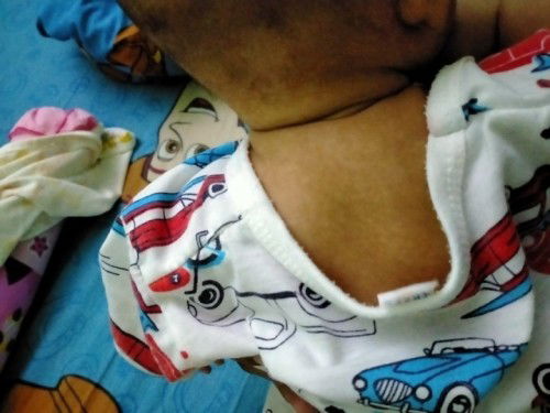 น้องเป็นอะไรคะ