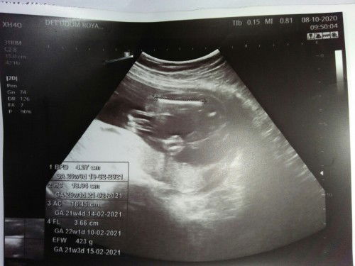 แบบนี้ ญ หรือ ช ค่ะ