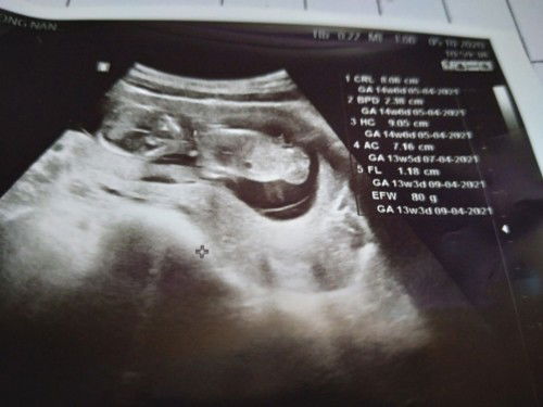 แม่ๆไหนอัลตราซาวดุเพศลูกกี่เดือนกันบ้างค่ะ
