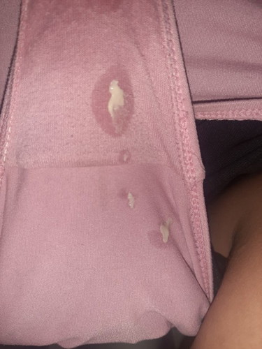 Mucus plug ?