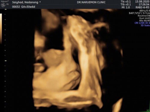 แตกแล้ววววจร้าาาาาา