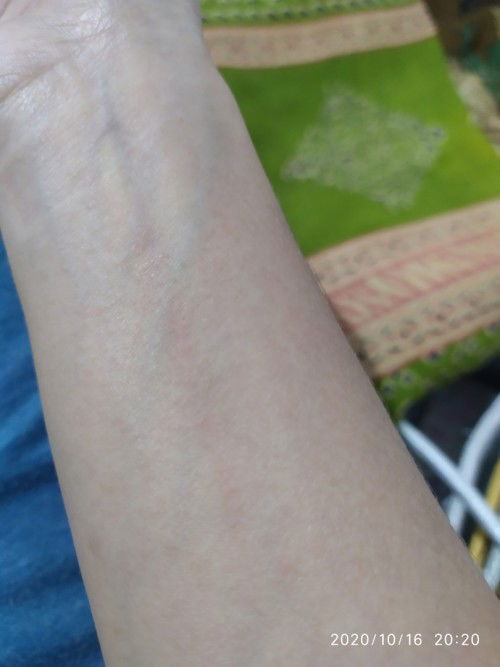 Gatal gatal di akhir 3smt pertama (11-12 minggu)