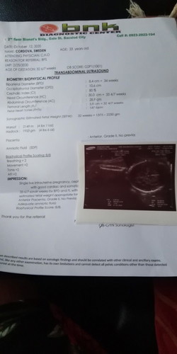 Ultra sound result,!