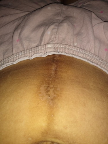 Looking for suggestions..