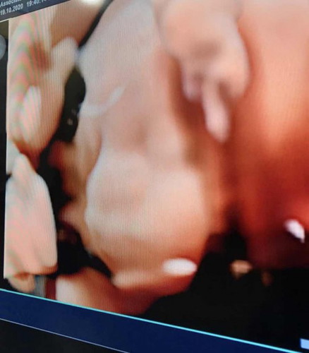 Mau tanya bun ini mancung apa ngga siπ