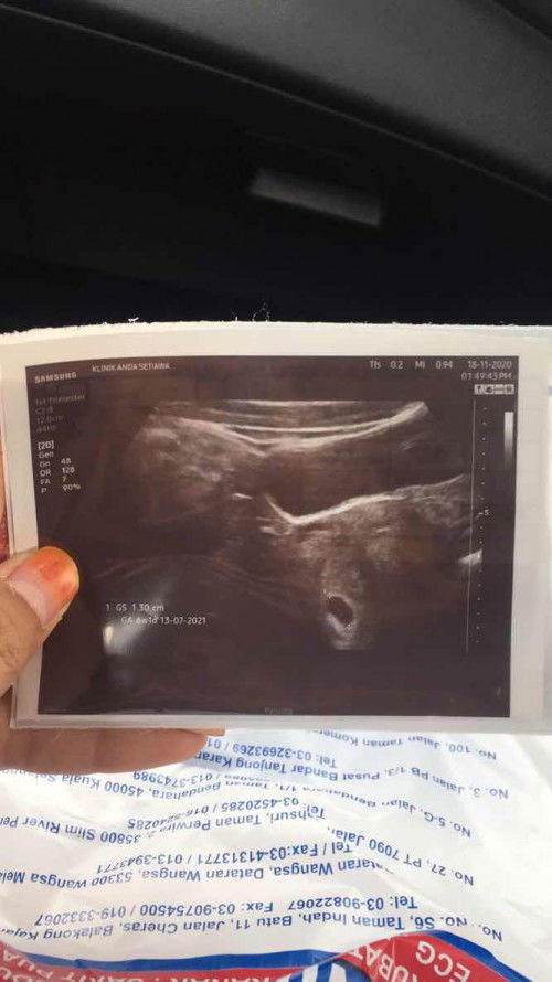 KALAU PERNAH GUGUR AKAN GUGUR LAGI KE ?