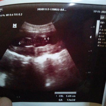 Binggung dan tkut jga sih