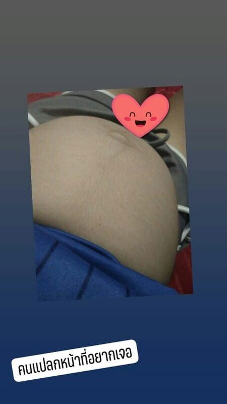 คุณแม่ท่านไหนพอทราบบ้างมั้ยค่ะว่าผญ./ผช. 32+2แล้วจ้า