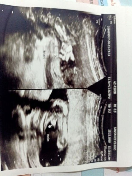 ทำไมไม่ค่อยรู้สึกว่าลูกดิ้นเลยค่ะ