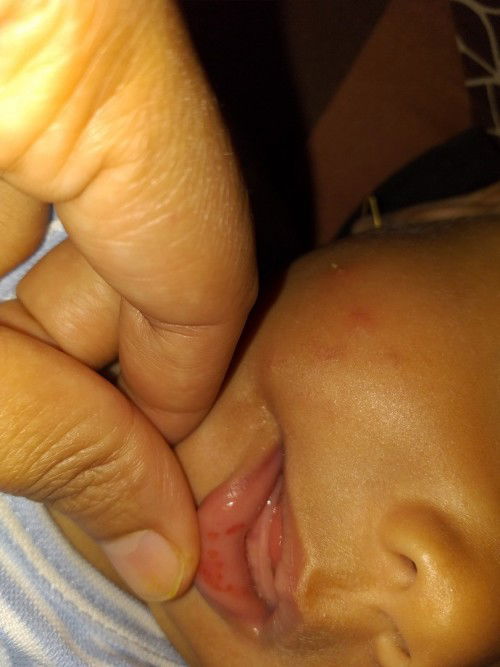 apakah ada yang pernah mengalami ini bun.