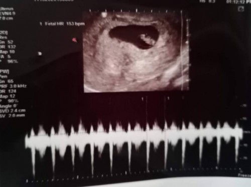 Mga mommies may tanong po ako.