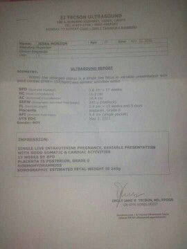 Good evening po . sakto lang ba yung laki at bigat ni baby para sa 17 weeks ?
#FTM 😍😘