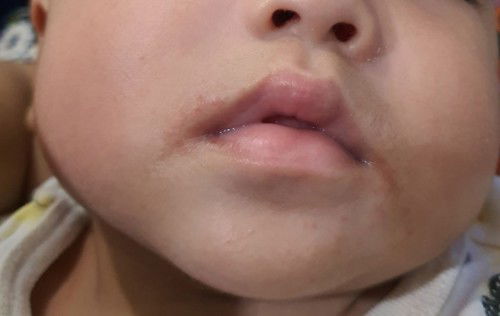 Kenapa ye merah macam ni?