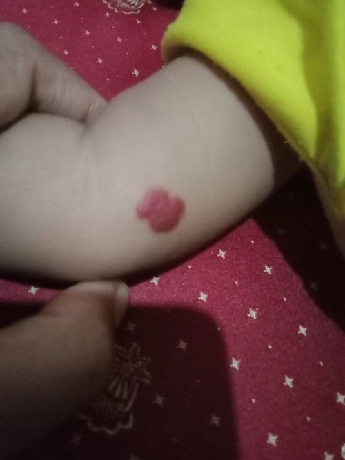 Tanda lahir atau bukan