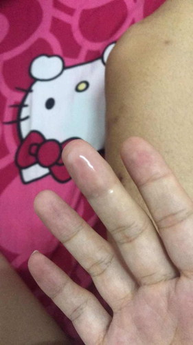 แม่ๆคนไหนเป็นแบบนี้บ้างคะ