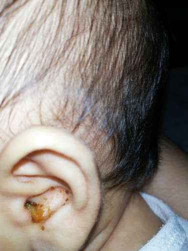 Ear infection?