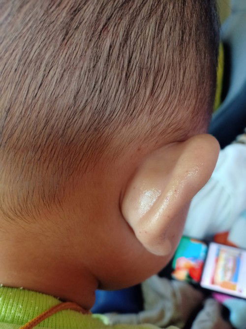 สวัสดีคะ คืออยากถามแม่ๆคะ 
แม่ๆบ้านไหนพอรู้มั้งคะ ว่าอาการแบบนี้เป็นไร มีไข้ ตัวร้อน งอแง 
มีจุดจ้ำๆ