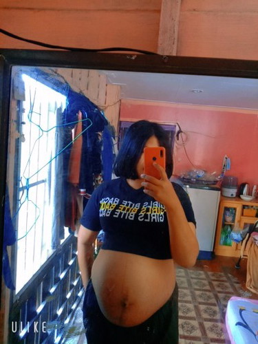 วิธีเร่งคลอด