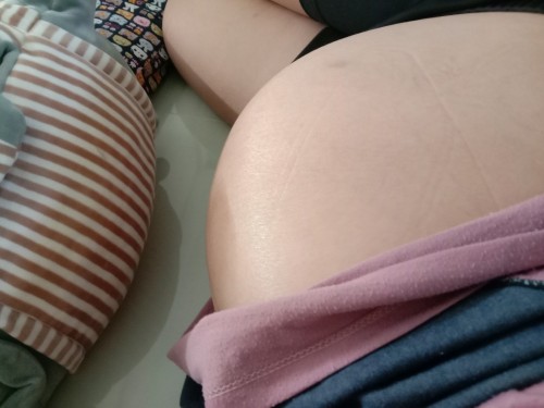 ปวดหลัง ปวดขา