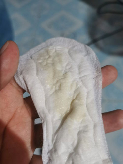 แบบนี้ใกล้คลอดมั้ย  39+4