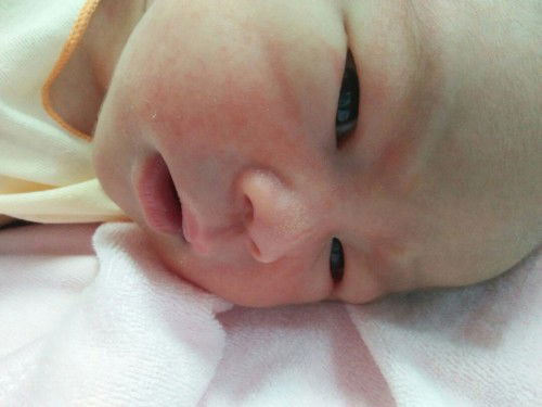 แชร์ประสบการ ผ่าคลอด+ทำหมัน