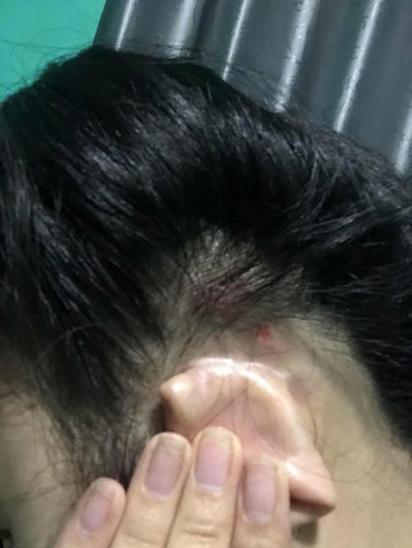 ตั้งเเต่ท้องมา หัวเน่าตลอดเลยค่ะ