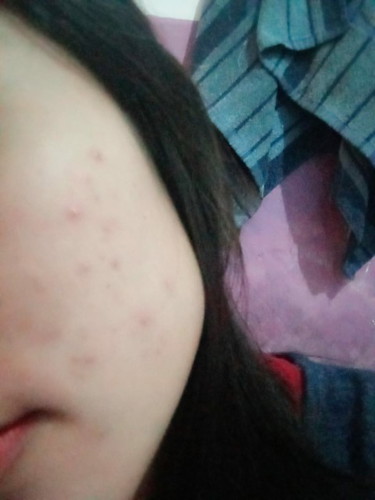 Kenapa ibu hamil sering sakit gigi bun udah kandungan 2 bulan gk sembuh"