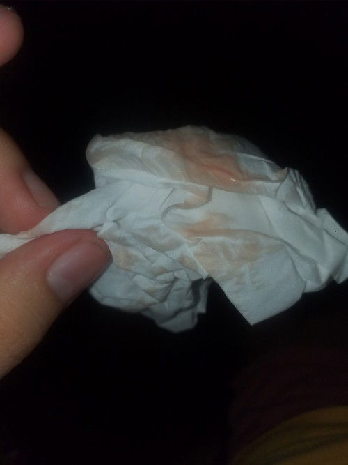 Discharge 38 weeks and 5 days