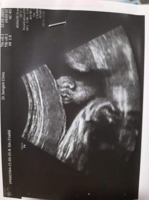 ช่วยเลือกชื่อลูกสาวหน่อยคะ​