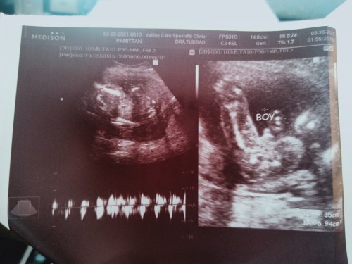 3rd baby,its a boy,!