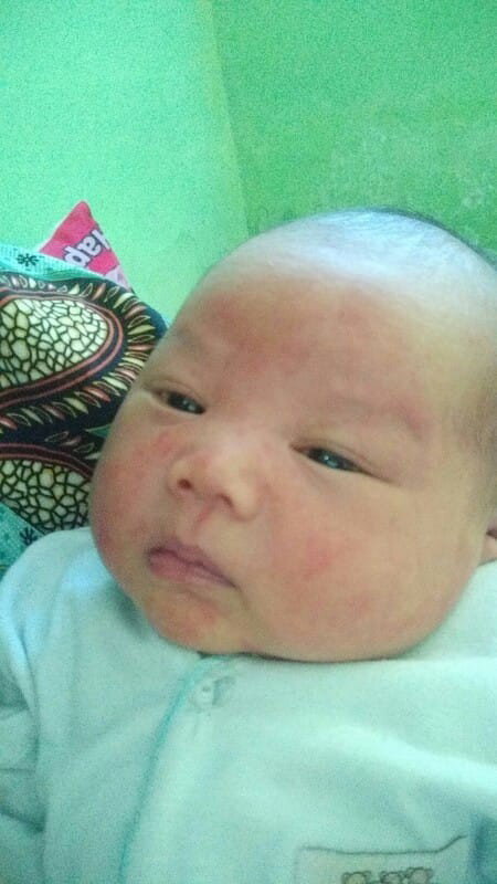 Wajah Merah2 anak baru 17 hari