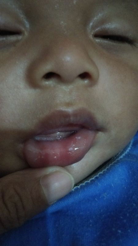 Noda putih sisa susu