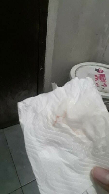 37+1มีมูกใสๆแล้วมีเลือดปนออกมานิดนึง มันคืออะไร อันตรายมั้ยคะแม่ๆ