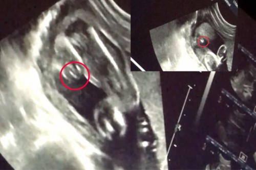 แม่ทีม กรกฏาคม